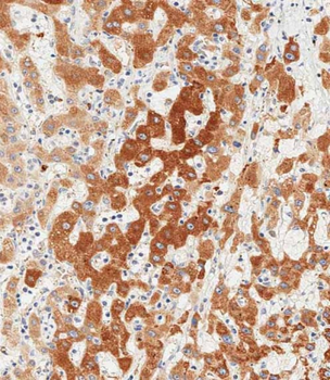 GPX7 Antibody (Center)