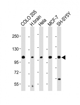 KCNH1 Antibody (C-Term)