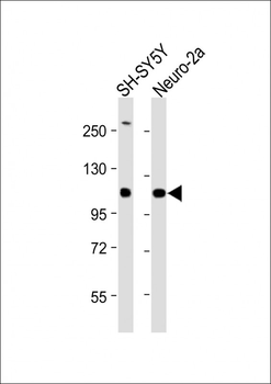 NEFH Antibody (Center)
