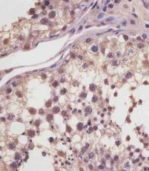 MGEA5 Antibody (N-Term)