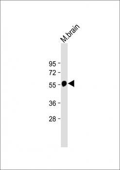 beta Tubulin Antibody
