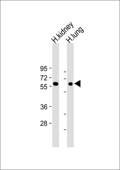MKS1 Antibody (N-Term)