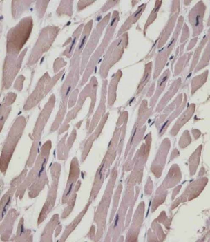 MYL1 Antibody (N-Term)
