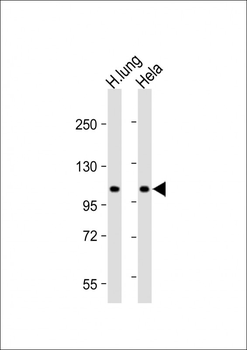 NAT10 Antibody (N-Term)