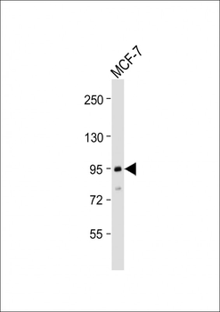 TGFBR3 Antibody (N-Term)