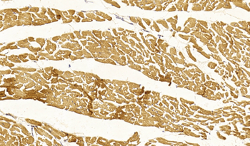 MYL2 Antibody (Center)