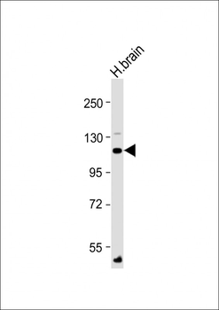 ATP1A4 Antibody (N-Term)