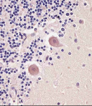 TNMD Antibody