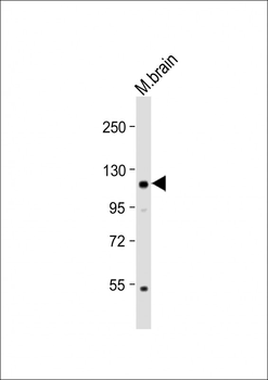 KL Antibody