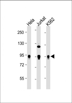 Wee1(S123) Antibody
