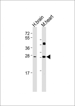 DKK2 Antibody