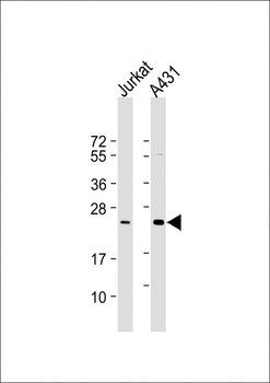 RAB7L1 Antibody