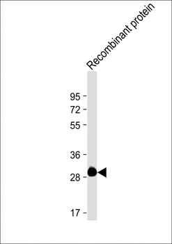 ROS1 Antibody