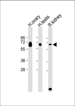 GGT3P Antibody (C-Term)