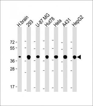 TOMM40 Antibody (N-Term)
