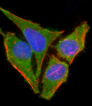 TAK1 (Ser439) Antibody