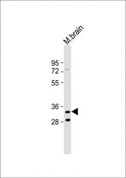 TMEM106B Antibody (C-Term)