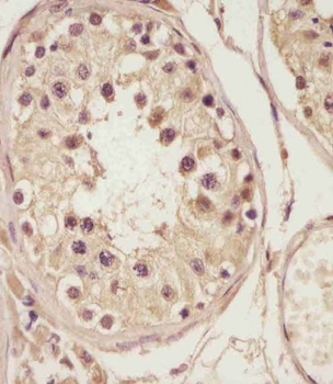 NSFL1C Antibody (Center)