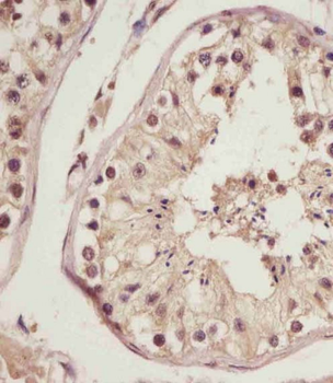NSFL1C Antibody (N-Term)
