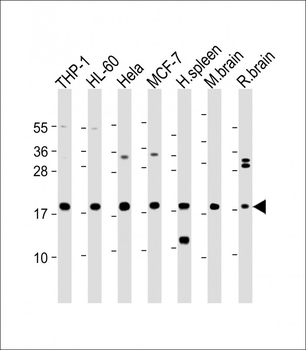 ARPC5 Antibody (Center)