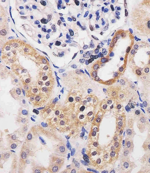 ADK Antibody (N-term)