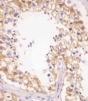 PDXK Antibody (N-term)