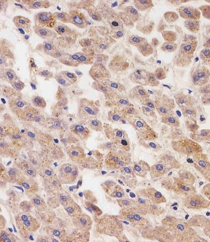 AFP Antibody