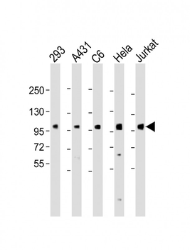 EEF2K (Ser366) Antibody