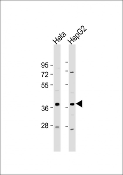 C1GALT1C1 Antibody (N-Term)