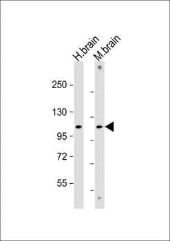 GBA2 Antibody (Center)