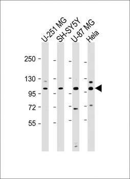 SH3PXD2B Antibody (Center)