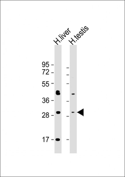 SRD5A1 Antibody (Center)
