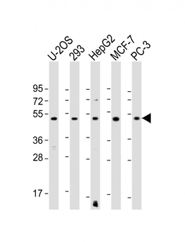 EEF1A1P5 Antibody (C-Term)