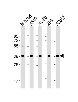 WBP2 Antibody (C-term)