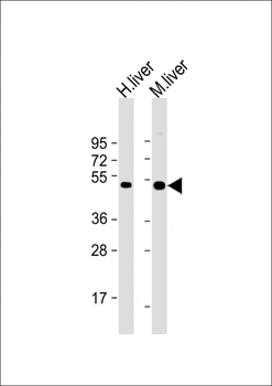 CTBS Antibody (Center)