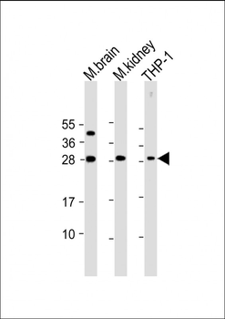 TPD52 Antibody (N-Term)