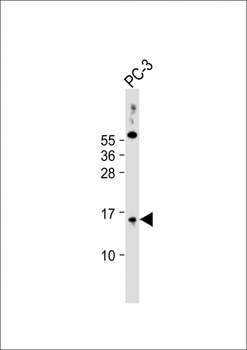 SYNJ2BP Antibody (N-Term)