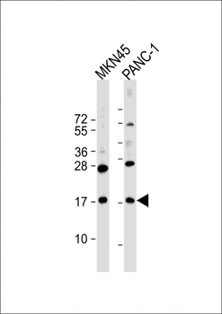 FAM159B Antibody (C-Term)