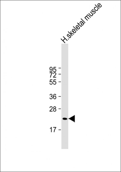 FNDC5 Antibody