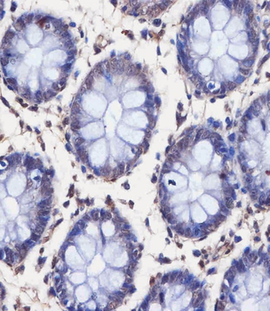 TAF4 Antibody (C-Term)