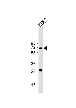 STT3A Antibody (Center)