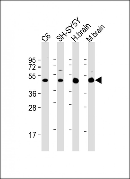 SLC2A3 Antibody (C-Term)