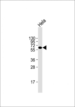 Natriuretic Peptide Receptor C Antibody