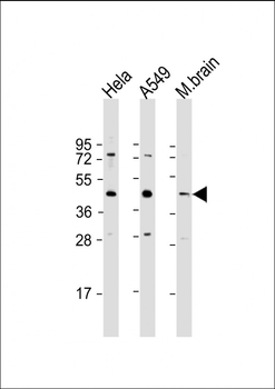 G6PC3 Antibody (C-Term)