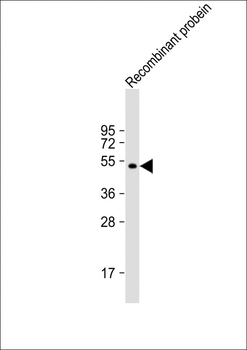 AKAP13 Antibody