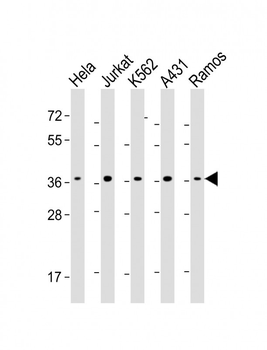 RAD51 Antibody