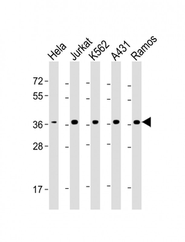 RAD51 Antibody