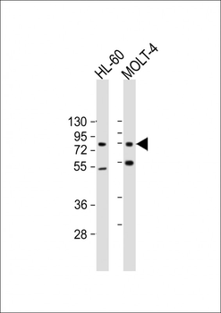 CBFA2T3 Antibody