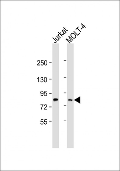 LCP2 Antibody (Center)