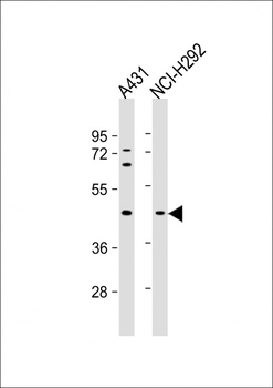 SERPINB3 Antibody